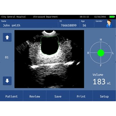 bladder scanner