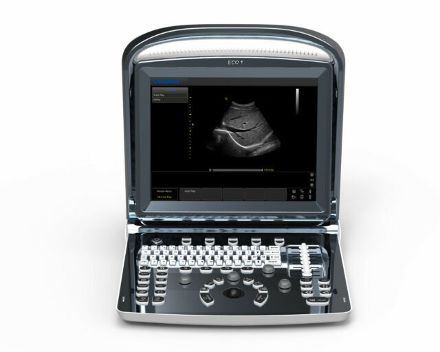  Chison-Ultraschallgerät online bestellen
