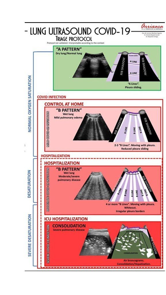 échographie pulmonaire COVID-19 triage